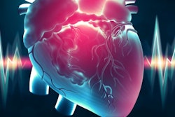 2021 01 29 22 24 0556 Cardiac Heart Eeg 400