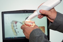 2021 02 10 23 53 8533 Scanner Intraoral Dental 400