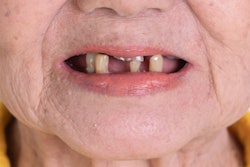 2022 01 24 02 31 5475 Missing Teeth Woman 400