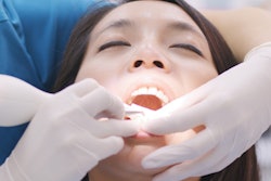 2023 01 24 00 15 0501 Dental Scaling Woman 400