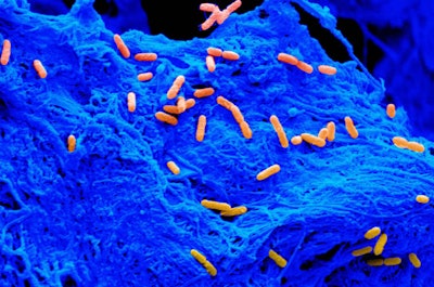 Individual P. aeruginosa cells (orange) on the surface of a collagen scaffold (blue). Image courtesy of Marley Dewey, University of Illinois Urbana-Champaign.