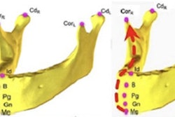 2023 03 09 23 54 8136 2023 03 10 Ct Ai Ortho 400
