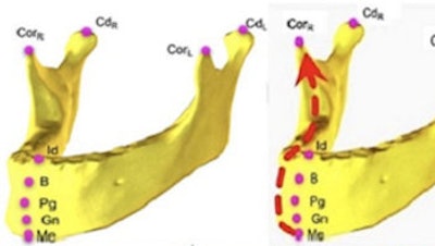 2023 03 09 23 54 8136 2023 03 10 Ct Ai Ortho 400