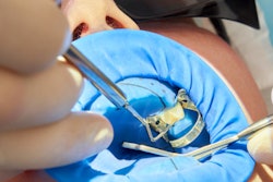 2023 03 14 15 51 8935 Dental Dam Patient 400