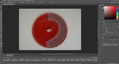 The inhibition area determined by Adobe Photoshop software. Images courtesy of Bennardo et al. Licensed by CC BY 4.0.