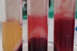 2023 03 15 16 19 8438 2023 03 15 Vancomycin Interference 400