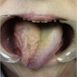 2023 03 20 20 27 1963 2023 03 21 Nerve Injury Anesthesia 400