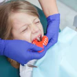 Girl Dental Mold