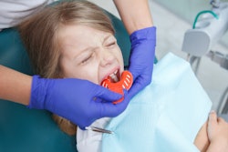 Girl Dental Mold