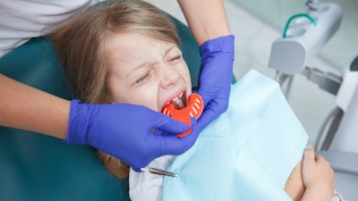 Girl Dental Mold