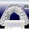 3D model shown in the OrthoCAD software program illustrating the diagnostic tool used to measure the widths of mesiodistal teeth.