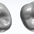 Natural tooth (left) compared with a tooth tailored generated by AI (right).
