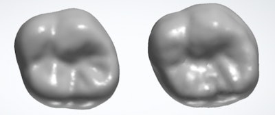 Natural tooth (left) compared with a tooth tailored generated by AI (right).