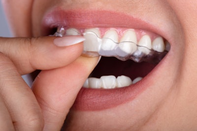 Clear Aligner Woman