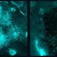 Before (left) and after (right) fluorescence images of fungal aggregates being removed by nanozyme microrobots without adhering to or disrupting the tissue sample.