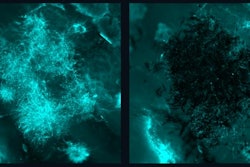 Before (left) and after (right) fluorescence images of fungal aggregates being removed by nanozyme microrobots without adhering to or disrupting the tissue sample.