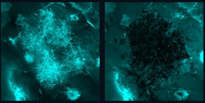 Before (left) and after (right) fluorescence images of fungal aggregates being removed by nanozyme microrobots without adhering to or disrupting the tissue sample.