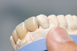 Dental Impression Denture