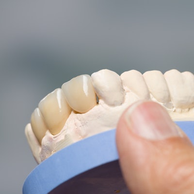 Dental Impression Denture