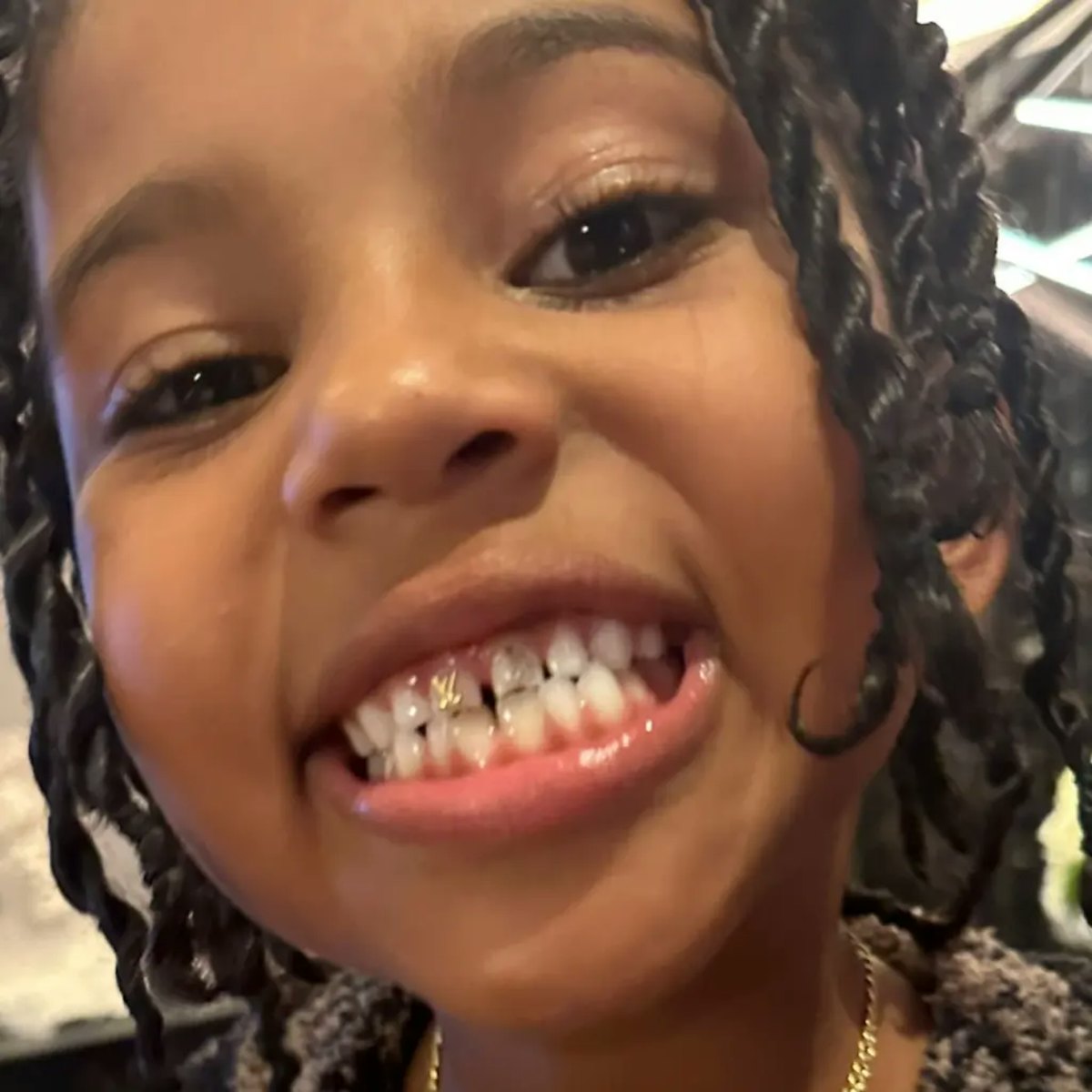 Kardashian's 7-year-old dons Louis Vuitton tooth gems