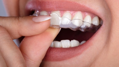 Clear Aligner Woman