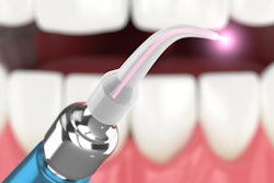 Dental Laser