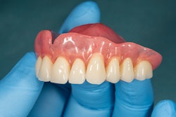 Denture Upper