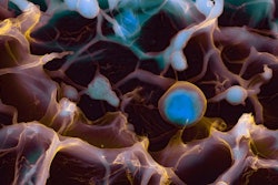 This image is a density-dependent colored scan of a piece of hydrogel using an electron microscope. Within the imaged hydrogel, regions higher in salt content are visualized as blue-colored regions, while less dense areas formed mainly by acrylamide are shown as red/purple.
