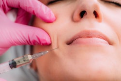 Filler Injection Needle