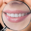 Teeth Magnifying Glass