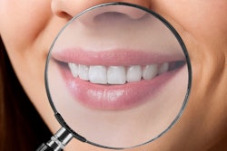 Teeth Magnifying Glass