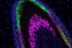 In this lab image of a developing incisor tooth, colors identify which genes are being expressed at each stage of development. Image courtesy of the University of Washington Dental Organoid Research Group.