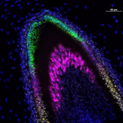 In this lab image of a developing incisor tooth, colors identify which genes are being expressed at each stage of development. Image courtesy of the University of Washington Dental Organoid Research Group.