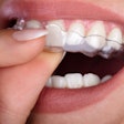 Clear Aligner Woman