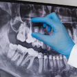 Dental X Ray