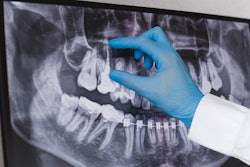 Dental X Ray
