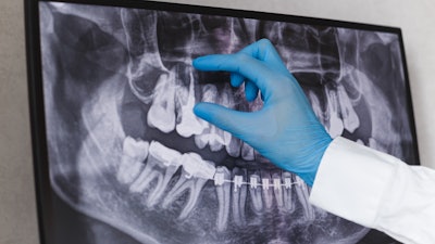 Dental X Ray