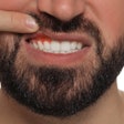 Inflamed Gums Man Resized
