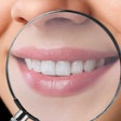 Teeth Magnifying Glass