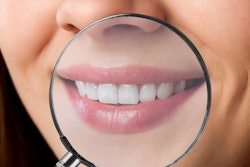 Teeth Magnifying Glass