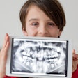 Boy Panoramic Xray
