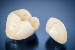 Dental Crowns