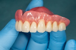 Denture Upper
