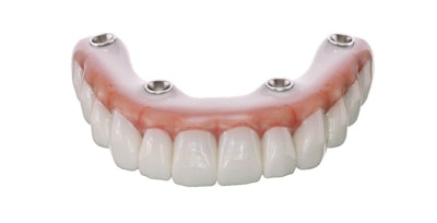 SprintRay's 3D-printed, fixed, implant-supported denture using OnX Tough 2. Image courtesy of SprintRay.