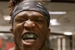 2023 10 11 Ksi Mouthguard