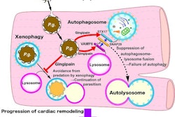 Gingipain released by P. gingivalis cleaves VAMP8, thereby inhibiting autophagy through preventing autophagosomes-lysosome fusion, which causes cardiac dysfunction. Image and caption courtesy of the department of cardiovascular medicine at Tokyo Medical Dental University.