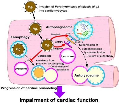 Gingipain released by P. gingivalis cleaves VAMP8, thereby inhibiting autophagy through preventing autophagosomes-lysosome fusion, which causes cardiac dysfunction. Image and caption courtesy of the department of cardiovascular medicine at Tokyo Medical Dental University.