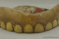 Francis Wharton's denture made of deer teeth