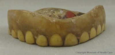 Francis Wharton's denture made of deer teeth
