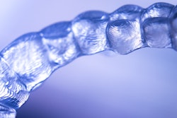 Clear Aligner
